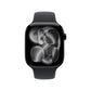 Apple watch S11